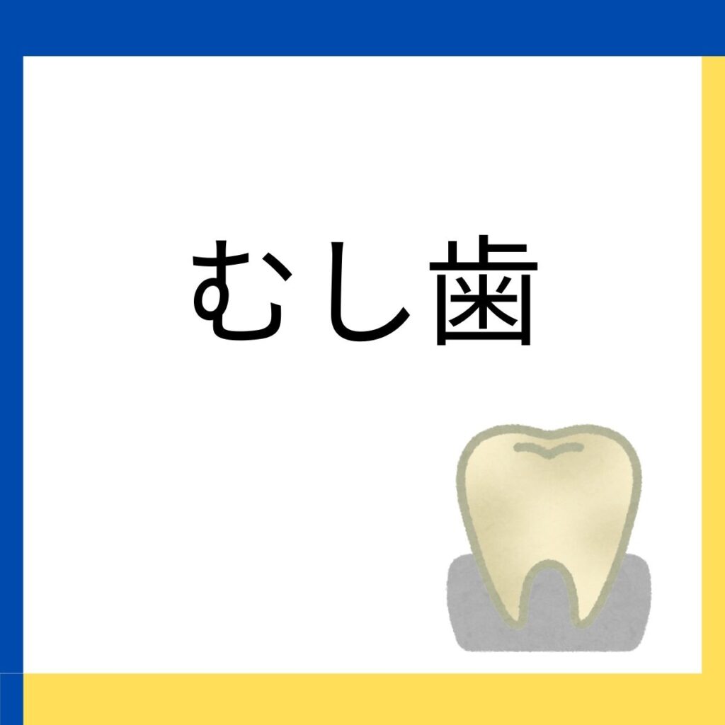 木町通ほしぞら歯科でのむし歯治療に関する説明のリンクを張り付けた画像
